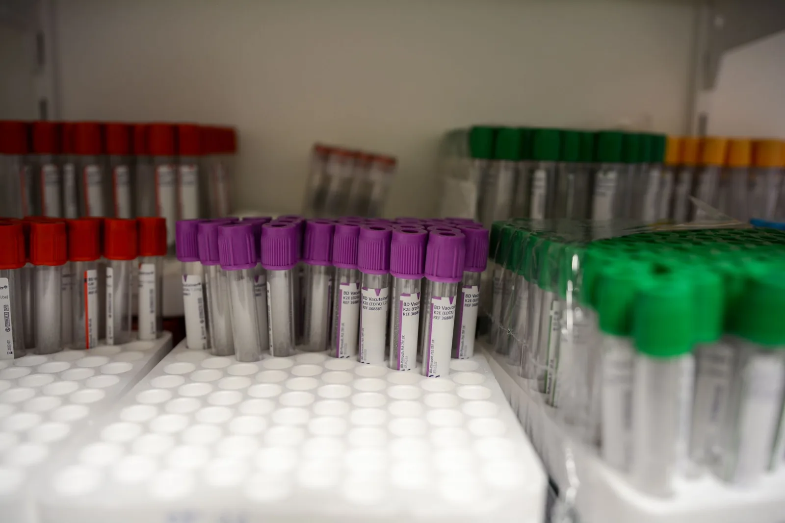 Rivejä verinäyteputkia laboratoriossa punaisin, violetein ja vihrein korkein