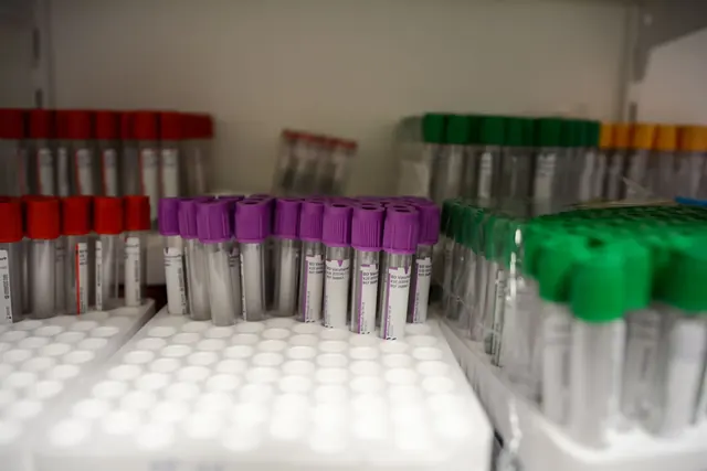 Rivejä verinäyteputkia laboratoriossa punaisin, violetein ja vihrein korkein